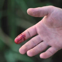 Bleeding That Doesn’t Stop: When Is It Serious?