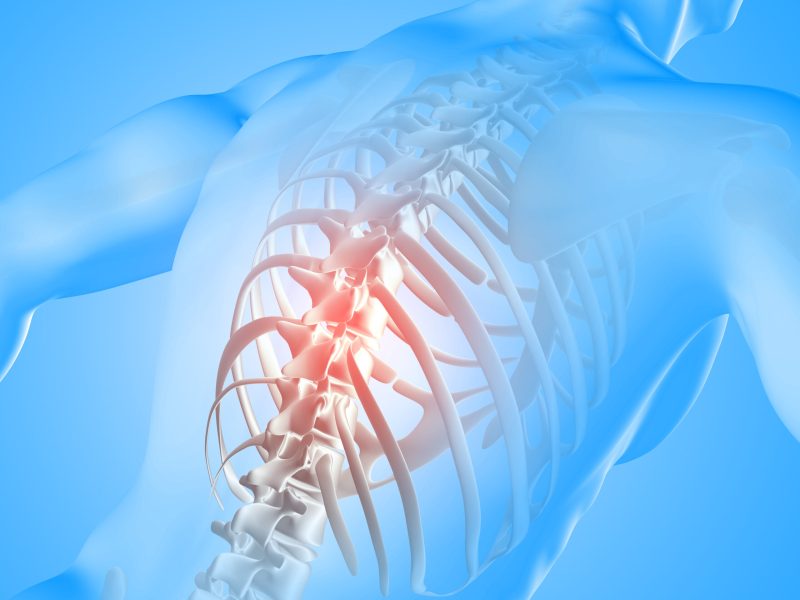 3D render of a medical image of a male figure with spine highlighted